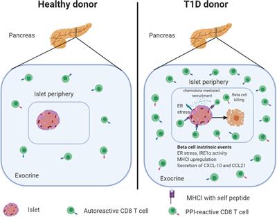 New Insights Into the Role of Autoreactive CD8 T Cells and Cytokines in Human Type 1 Diabetes